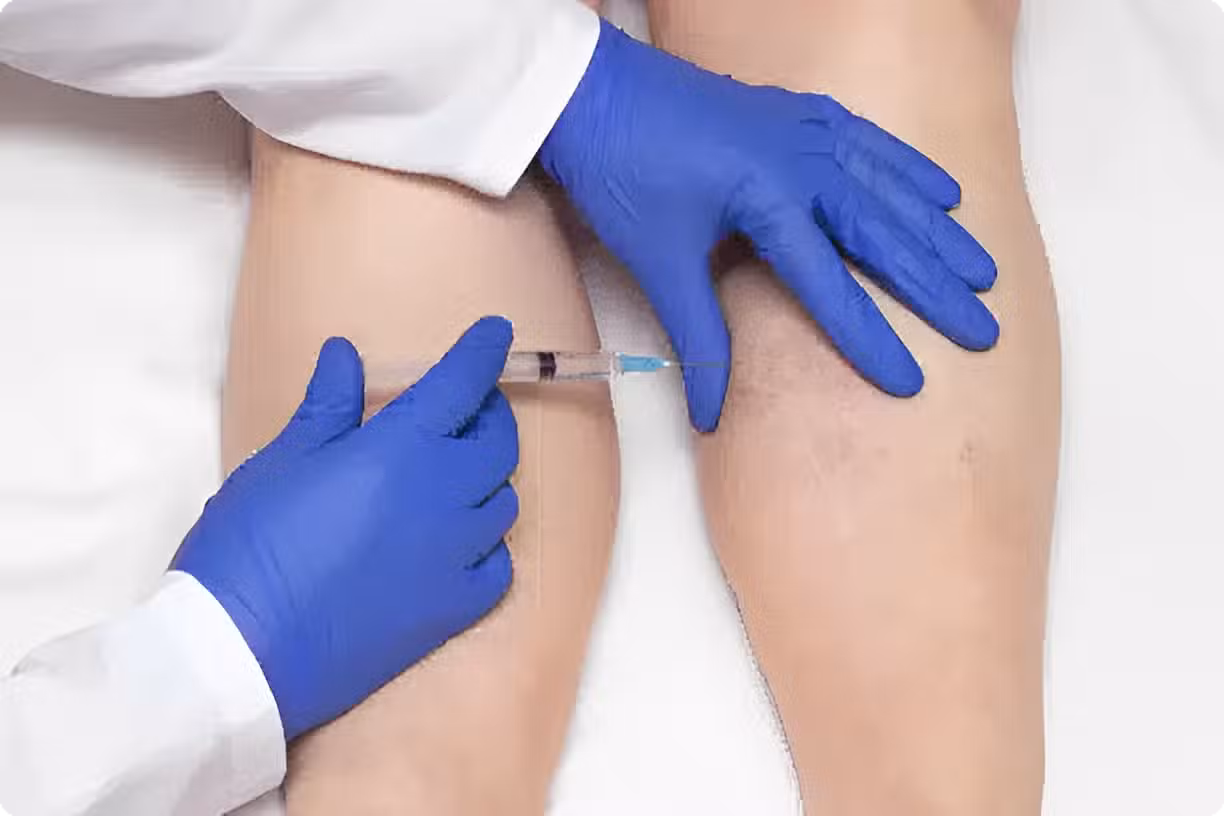 Vein Treatments in Walnut Creek, CA